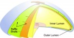 IDEAL Implant clinical trial results