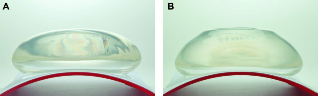 Figure 2 Figure 2