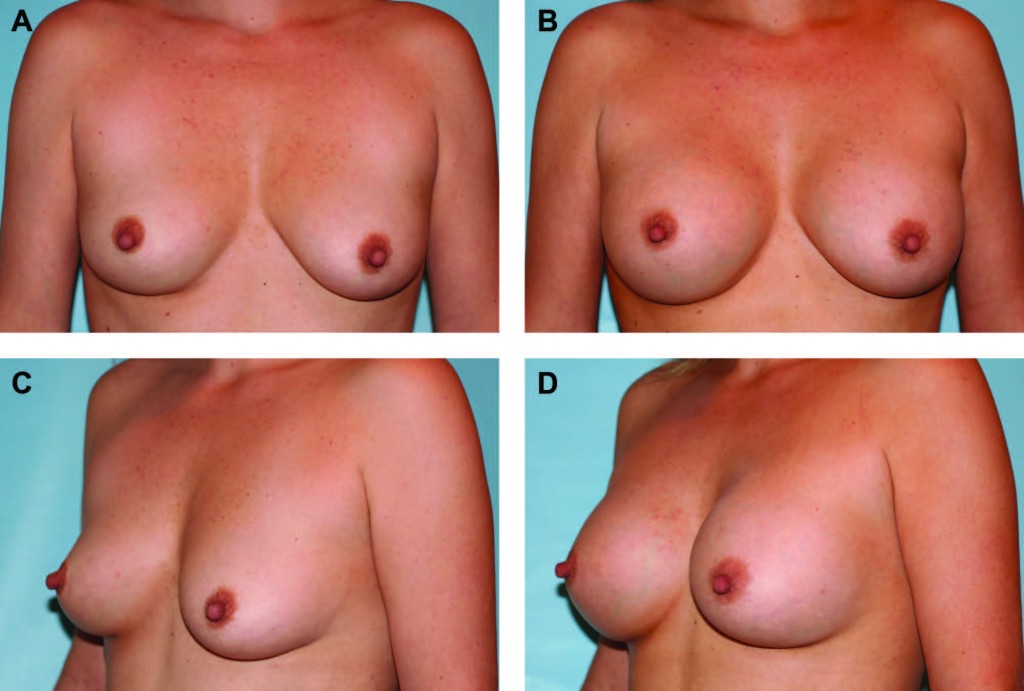 Figure 5 Figure 5
