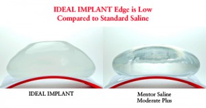 IDEAL Breast Implant