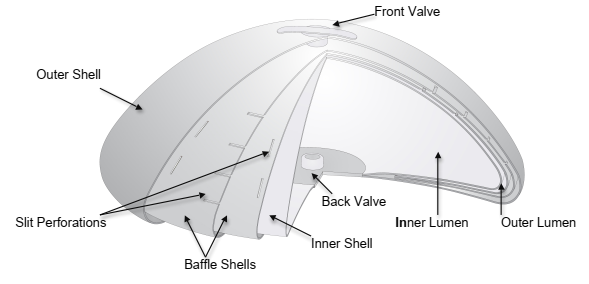 IDEAL Breast Implant