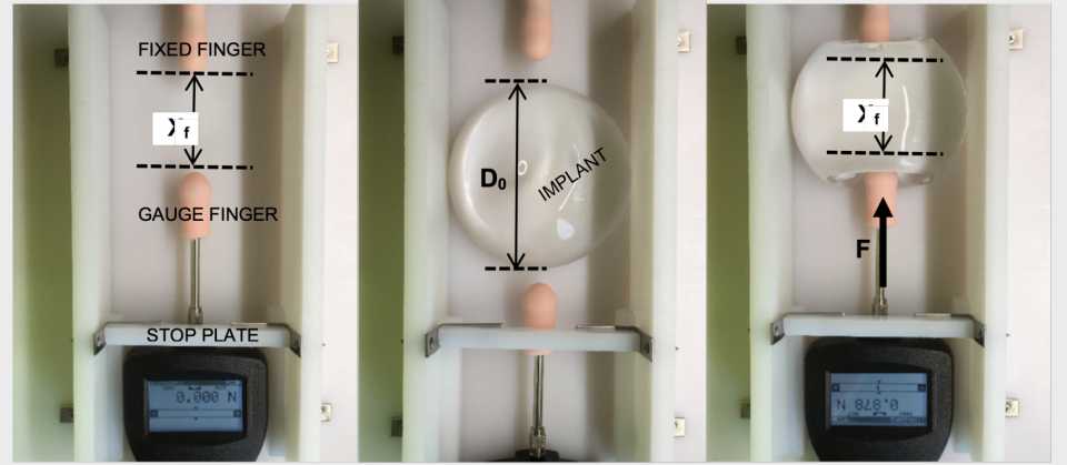 Figure 17
